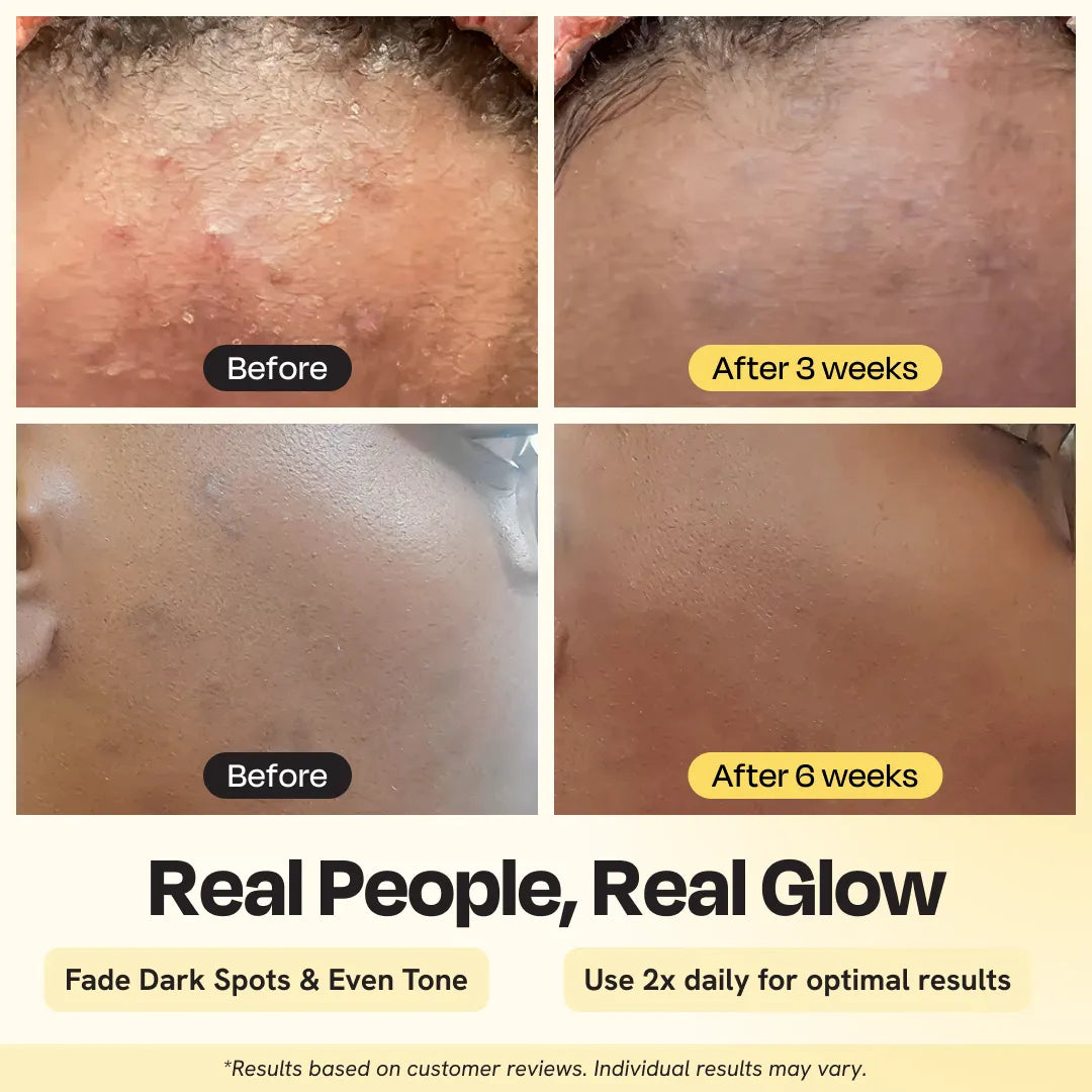 Advanced Brightening Moisturizer  1.7 oz- 50 ml