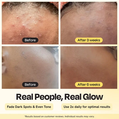 Advanced Brightening Moisturizer  1.7 oz- 50 ml