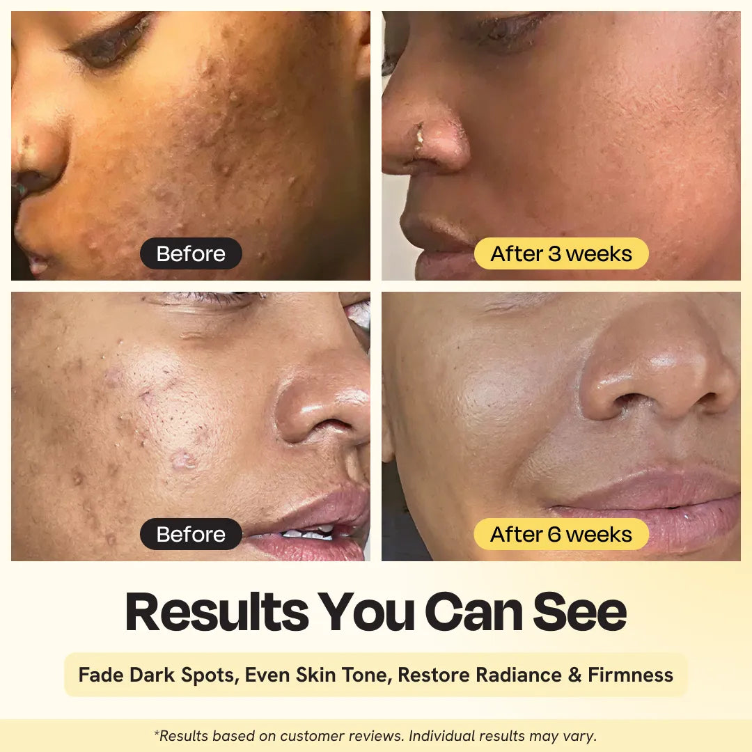 Superactive Serum 1 oz- 30 ml